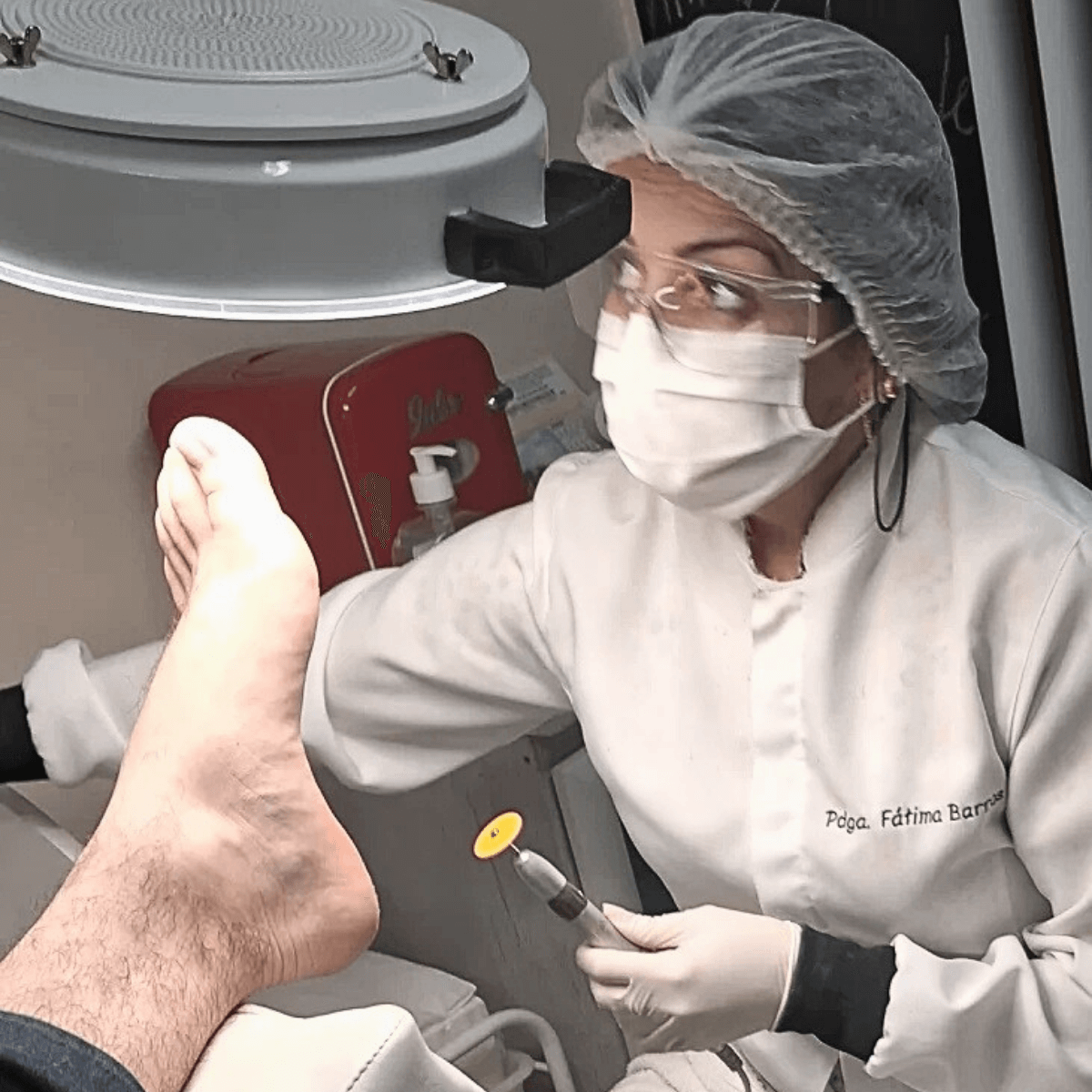 Procedimento de desbaste plantar para remoção de pele morta