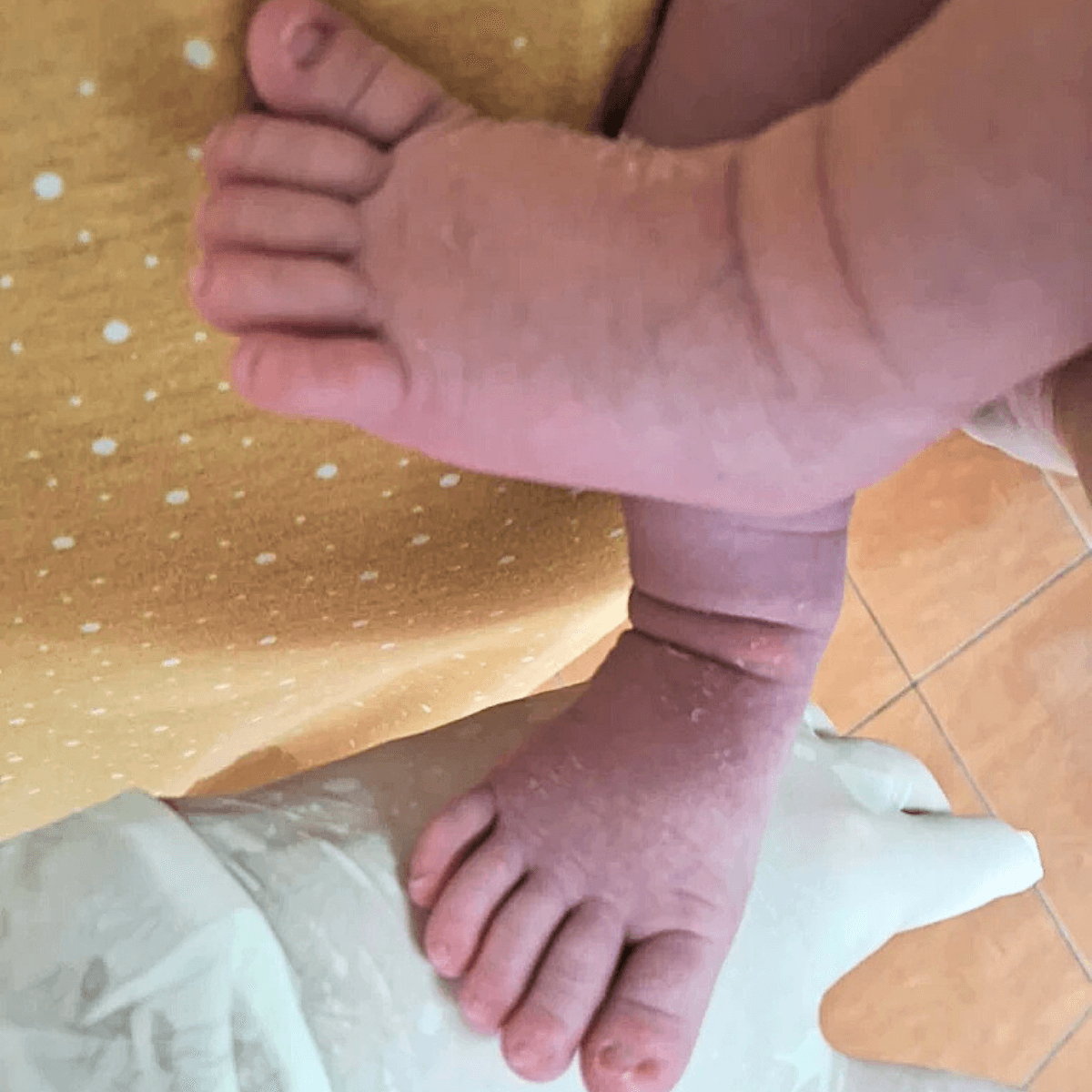 Cuidado delicado e especializado com os pés de crianças